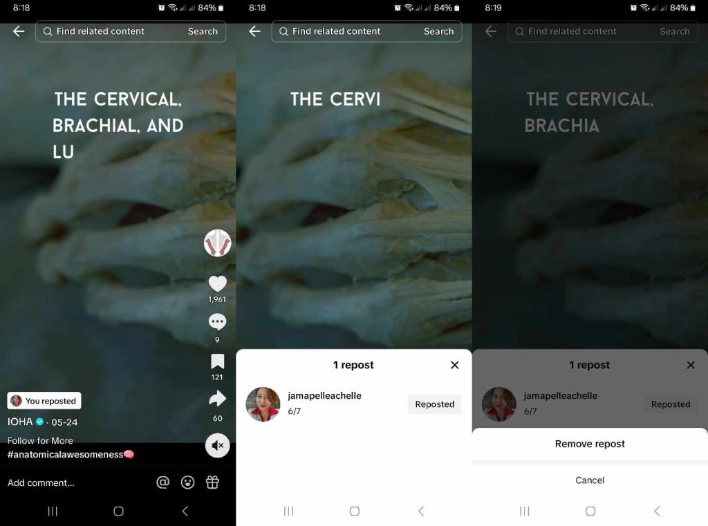 High Social’s screenshots show how to undo a repost on TikTok.